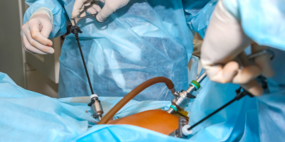 Advanced Laparoscopic & Endoscopic Surgeries